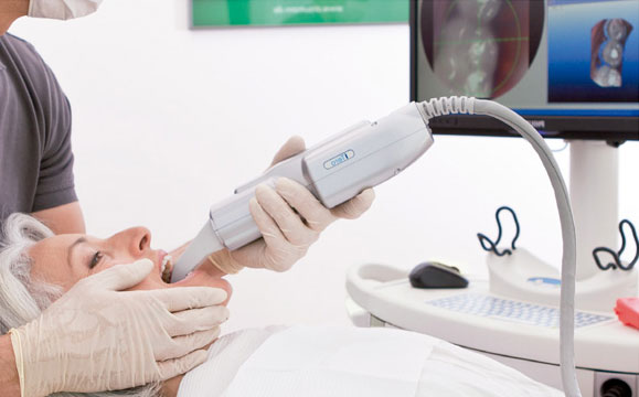 Dentist scanning with an intraoral scanner LED light projection..png